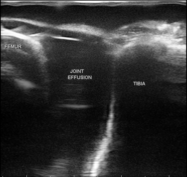 膝關節肌肉骨骼超音波訓練模型超音波影像