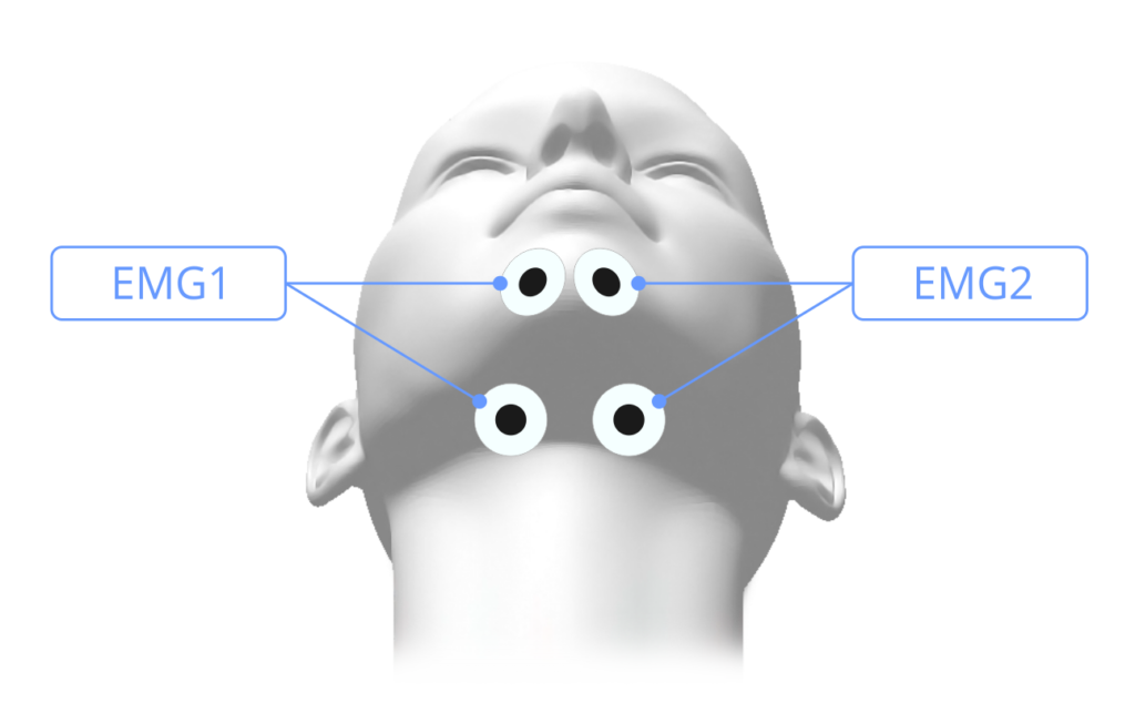 臉部 EMG 記錄的通用電極放置位置