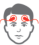 腦電圖 (EEG)